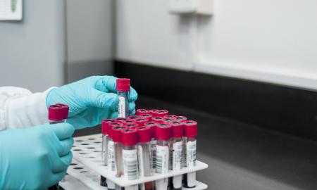 Bijote cholesterolio? Gal neverta – tiesa nustebins