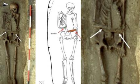 Archeologai aptiko šiurpų radinį: viduramžiais miręs vyras vietoje nukirstos rankos buvo įsitaisęs protezą-peilį (Foto)