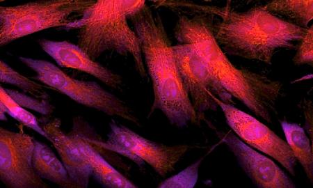 Pavyko atsukti biologinį laikrodį atgal: senėjimą naikinanti technika odos ląsteles atjaunina 30 metų