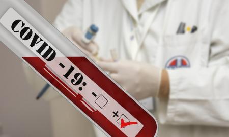 COVID-19 ligos pasekmės – ne visada apčiuopiamos: į ką vertėtų atkreipti dėmesį?