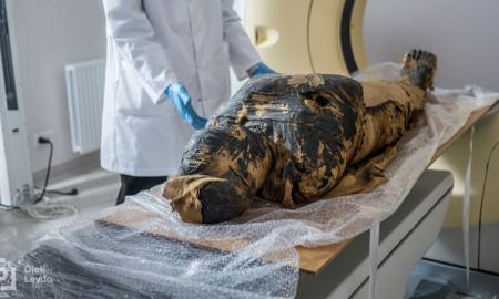 Egipto mumiją kompiuteriniu tomografu nuskenavę mokslininkai jos galvoje aptiko didžiulį darinį, pilve – kūdikį (Foto, Video)