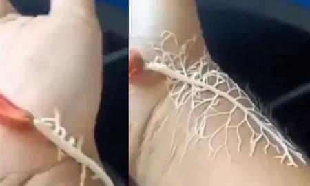 Kaip iš siaubo filmo: internete kilo tikra audra dėl kraupaus kirmino, kuris sukuria baltą tinklą (Video)