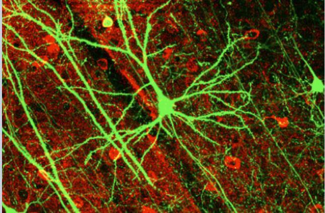 Neuronai