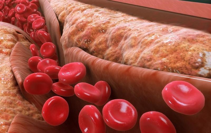 Cholesterolis