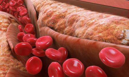 Kaip sumažinti cholesterolį? Išbandykite paprastą ir skanų būdą