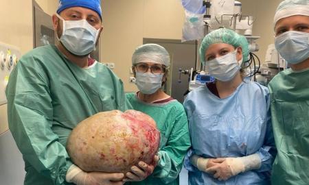 Šokiruojanti operacija: gydytojai pašalino 20 kg naviką – pavėluota patikra vos nekainavo gyvybės (Foto)
