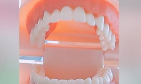 Ateina sensacija. Implantų nebereikės – dantys augs patys (Foto)