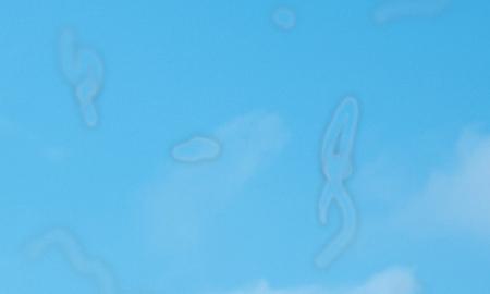 Keisti plūduriuojantys dariniai akyse. Panašūs į kirminus. Kas tai? (VIDEO)