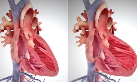 Susirūpinkite: šis veiksnys širdžiai pavojingesnis nei diabetas ir cholesterolis