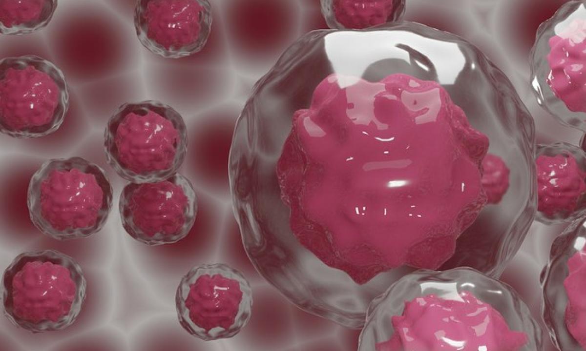 Paaiškėjo, kad populiarus vaistas žudo vėžio ląsteles