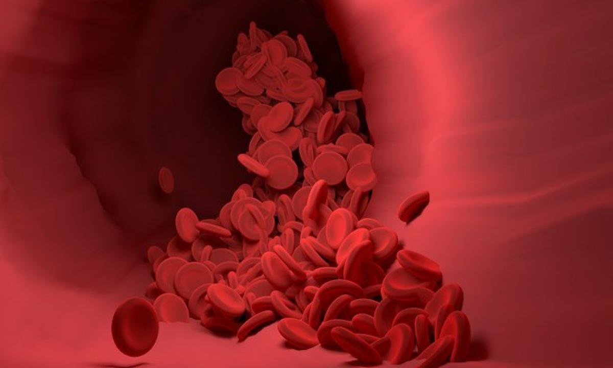 Medikas pasakė, koks maistas valo kraujagysles: tirpdo apnašas ir saugo nuo krešulių