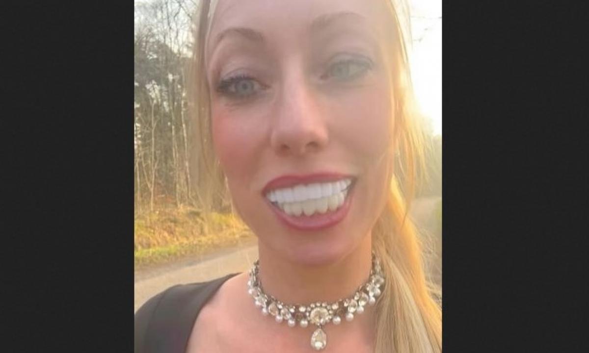 Ji pademonstravo savo „turkiškus dantis“. „Aš paprašiau natūralių“ (Foto, Video)