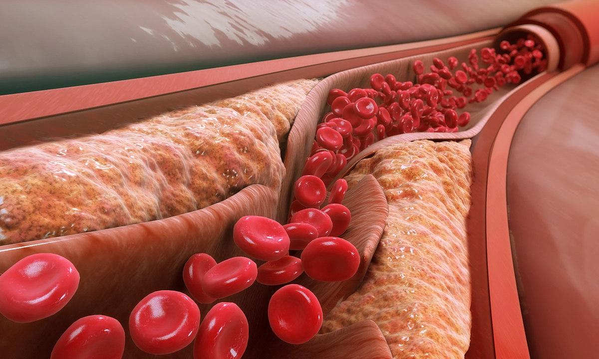 Jis dažnai lieka nepastebėtas lentynose, bet būtent šis produktas yra tikrasis cholesterolio priešas