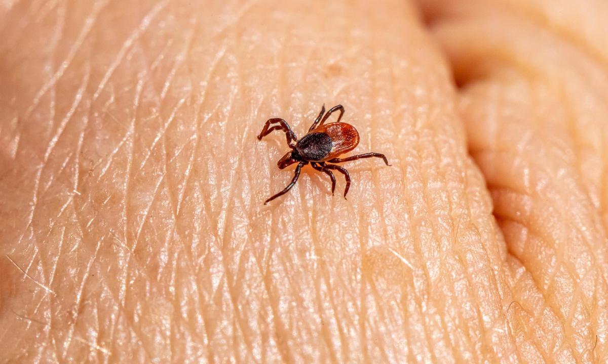 Jis pašalino tūkstančius erkių. Gydytojo metodas yra absoliutus hitas