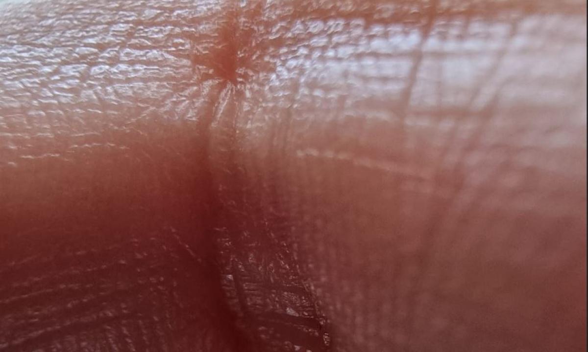 Mokslininkai pakraupo: jūsų oda turi paslėptą signalizaciją – sužeista ji pradeda rėkti